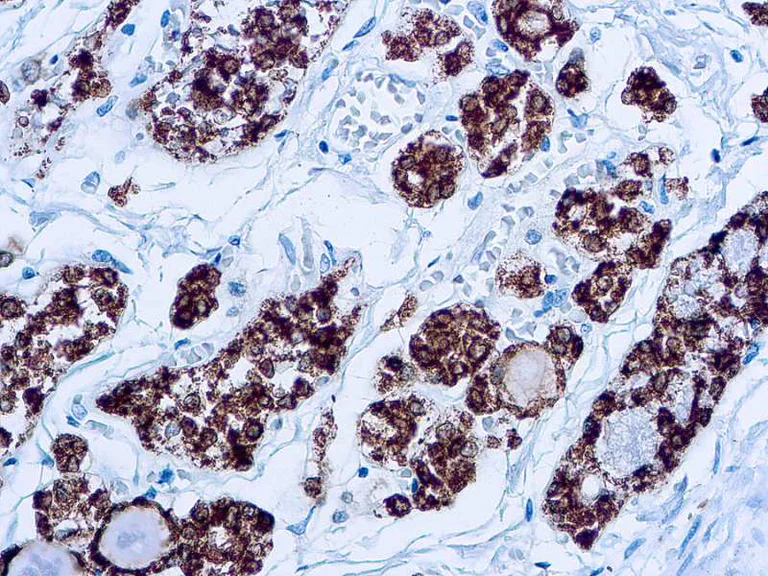Immunohistochemistry (Formalin/PFA-fixed paraffin-embedded sections) - Anti-Thyroid Peroxidase/TPO antibody [MoAb47] (AB12500)