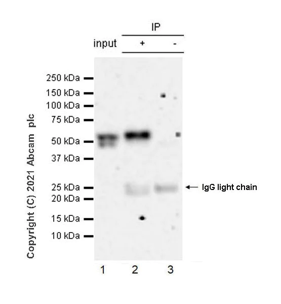 Immunoprecipitation - Anti-Thyroxine Binding Globulin antibody [EPR24453-121] (AB280954)