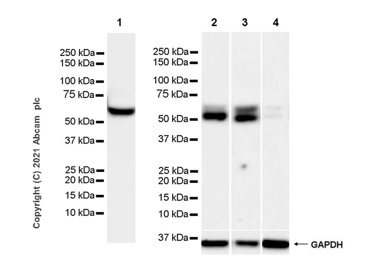 Western blot - Anti-Thyroxine Binding Globulin antibody [EPR24453-121] - BSA and Azide free (AB280962)
