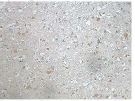 Immunohistochemistry (Formalin/PFA-fixed paraffin-embedded sections) - Anti-TIA1 antibody (AB205063)