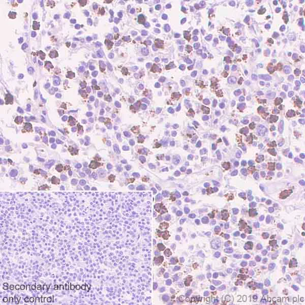 Immunohistochemistry (Formalin/PFA-fixed paraffin-embedded sections) - Anti-TIA1 antibody [EPR22999-80] (AB263945)