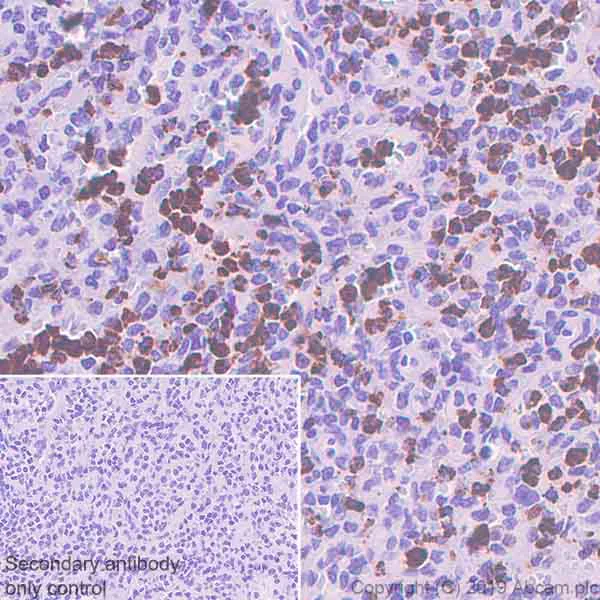 Immunohistochemistry (Formalin/PFA-fixed paraffin-embedded sections) - Anti-TIA1 antibody [EPR22999-80] (AB263945)
