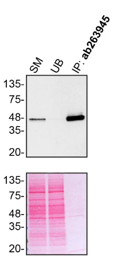 Immunoprecipitation - Anti-TIA1 antibody [EPR22999-80] (AB263945)