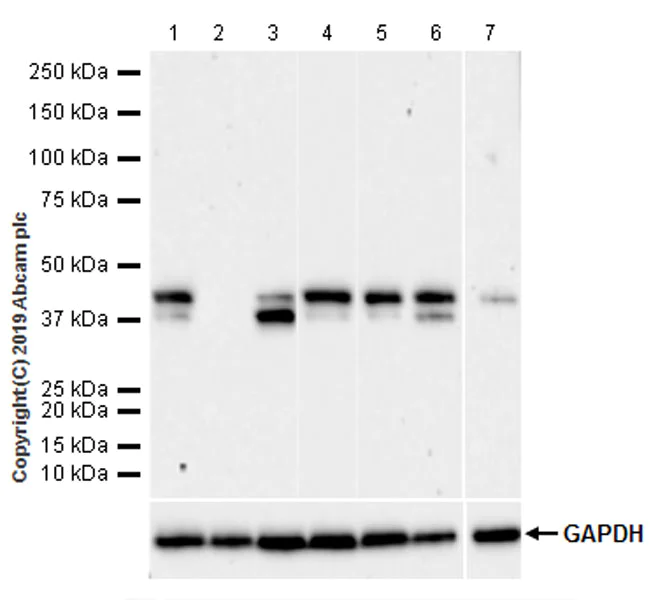 Western blot - Anti-TIA1 antibody [EPR22999-80] (AB263945)