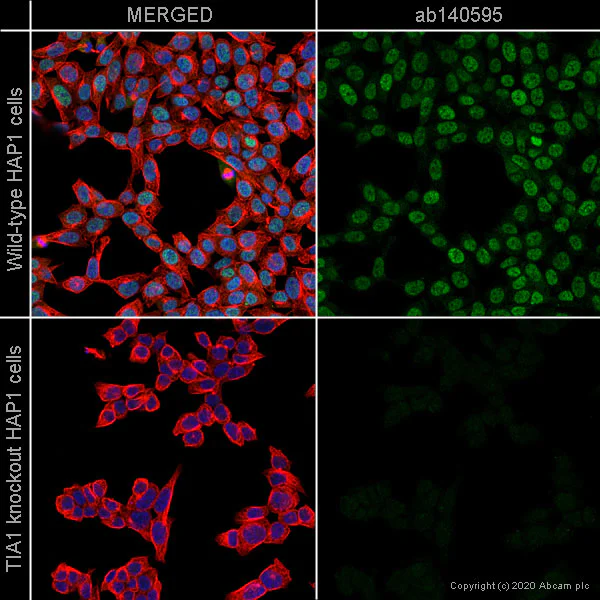 Immunocytochemistry/ Immunofluorescence - Anti-TIA1 antibody [EPR9304] (AB140595)