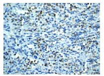 Immunohistochemistry (Formalin/PFA-fixed paraffin-embedded sections) - Anti-TIA1 antibody [EPR9304] (AB140595)
