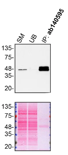 Immunoprecipitation - Anti-TIA1 antibody [EPR9304] (AB140595)