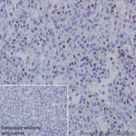 Immunohistochemistry (Formalin/PFA-fixed paraffin-embedded sections) - Anti-TIA1 antibody [EPR9304] - BSA and Azide free (AB230829)