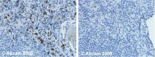 Immunohistochemistry (Formalin/PFA-fixed paraffin-embedded sections) - Anti-TIA1 antibody [TIA-1] (AB2712)
