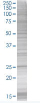SDS-PAGE - TIA1 overexpression 293T lysate (whole cell) (AB94248)