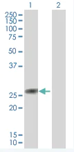 Western blot - TIA1 overexpression 293T lysate (whole cell) (AB94248)