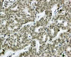 Immunohistochemistry (Formalin/PFA-fixed paraffin-embedded sections) - Anti-TIAL1 antibody [EPR11323(B)] (AB169547)