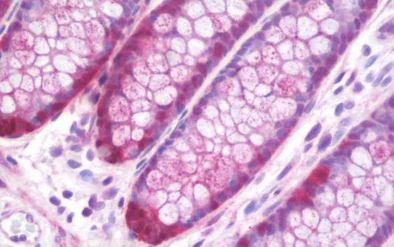 Immunohistochemistry (Formalin/PFA-fixed paraffin-embedded sections) - Anti-TIAM1 antibody (AB211518)