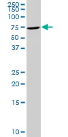 Western blot - Anti-TIAM2 antibody (AB103578)