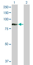 Western blot - Anti-TIAM2 antibody (AB103578)