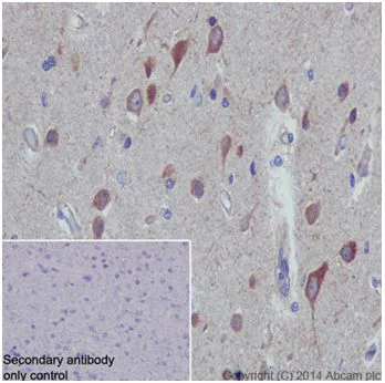 Immunohistochemistry (Formalin/PFA-fixed paraffin-embedded sections) - Anti-TIAM2 antibody [EPR16838] (AB199426)