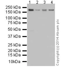 Western blot - Anti-TIAM2 antibody [EPR16838] (AB199426)