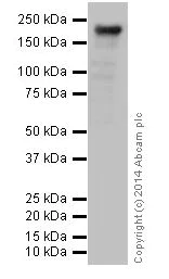 Western blot - Anti-TIAM2 antibody [EPR16838] (AB199426)