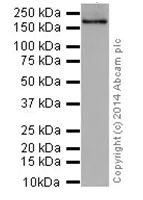 Western blot - Anti-TIAM2 antibody [EPR16838] (AB199426)
