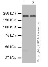 Western blot - Anti-TIAM2 antibody [EPR16838] (AB199426)