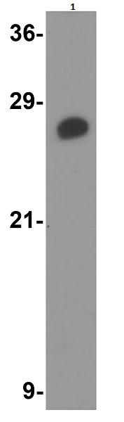 Western blot - Anti-TICAM2 antibody (AB17221)
