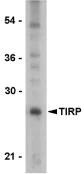 Western blot - Anti-TICAM2 antibody (AB17221)