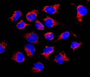 Immunocytochemistry/ Immunofluorescence - Anti-TID1 antibody [EPR12414] - BSA and Azide free (AB250291)