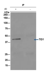 Immunoprecipitation - Anti-TID1 antibody [EPR12414] - BSA and Azide free (AB250291)