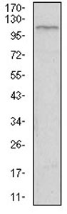 Western blot - Anti-TIE1 antibody [8D12D2] (AB201986), expandable thumbnail