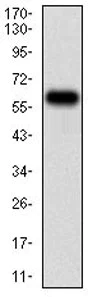 Western blot - Anti-TIE1 antibody [8D12D2] (AB201986)