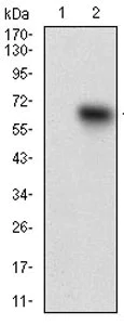 Western blot - Anti-TIE1 antibody [8D12D2] (AB201986)