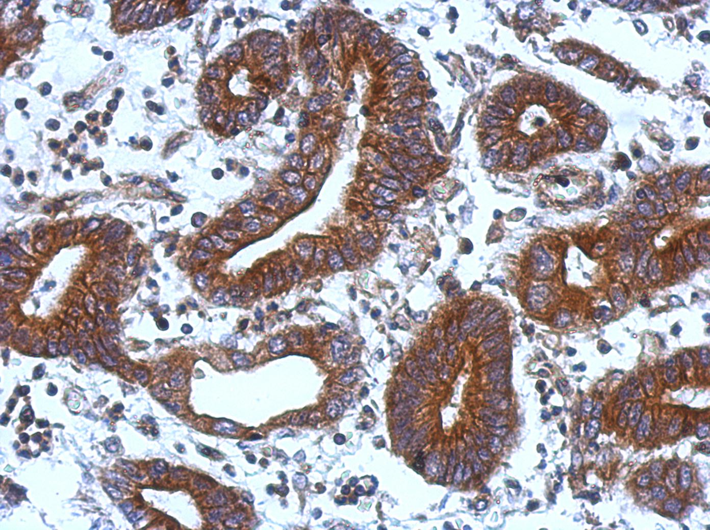 Immunohistochemistry (Formalin/PFA-fixed paraffin-embedded sections) - Anti-TIE1 antibody (AB111547), expandable thumbnail
