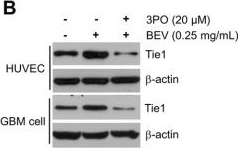 Western blot - Anti-TIE1 antibody (AB111547), expandable thumbnail