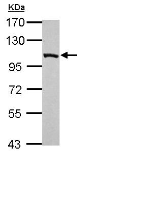 Western blot - Anti-TIE1 antibody (AB111547), expandable thumbnail