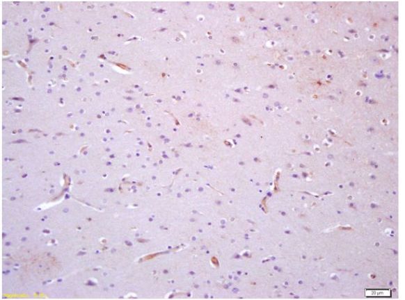 Immunohistochemistry (Formalin/PFA-fixed paraffin-embedded sections) - Anti-TIE1 antibody (AB203078)