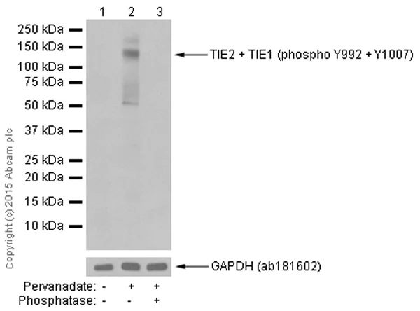 Western blot - Anti-TIE1 (phospho Y1007) + TIE2 (phospho Y992) antibody [EPR1053(N)(B)] (AB151704)
