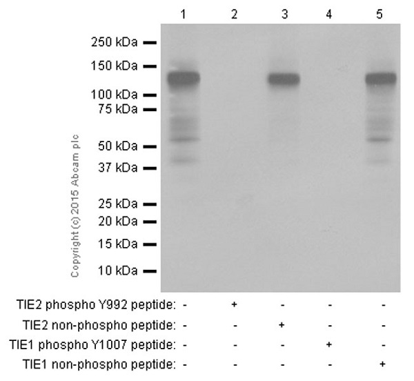 Western blot - Anti-TIE1 (phospho Y1007) + TIE2 (phospho Y992) antibody [EPR1053(N)(B)] (AB151704)