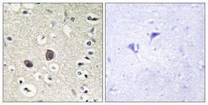 Immunohistochemistry (Formalin/PFA-fixed paraffin-embedded sections) - Anti-TIE2 antibody (AB111074)