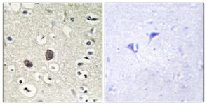 Immunohistochemistry (Formalin/PFA-fixed paraffin-embedded sections) - Anti-TIE2 antibody (AB111074)