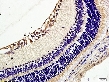 Immunohistochemistry (Formalin/PFA-fixed paraffin-embedded sections) - Anti-TIE2 antibody (AB218051)