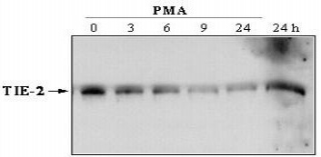Western blot - Anti-TIE2 antibody [Cl. 16] - BSA and Azide free (AB24859)
