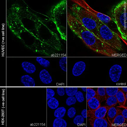 Immunocytochemistry/ Immunofluorescence - Anti-TIE2 antibody [EPR21915] (AB221154)