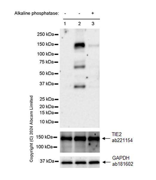 Western blot - Anti-TIE2 antibody [EPR21915] (ab221154), expandable thumbnail