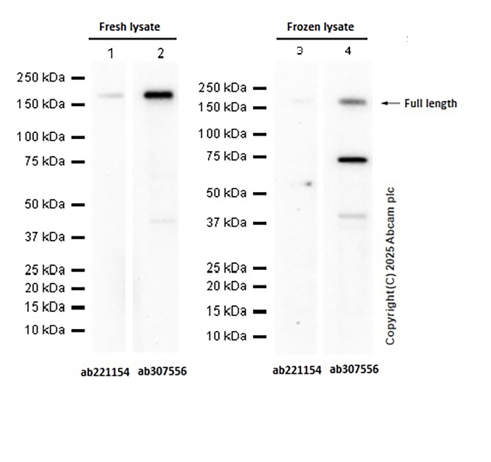Western blot - Anti-TIE2 antibody [EPR21915] (ab221154), expandable thumbnail