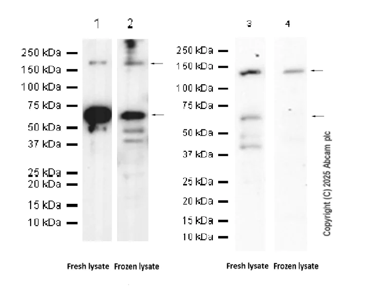 Western blot - Anti-TIE2 antibody [EPR21915] (AB221154)