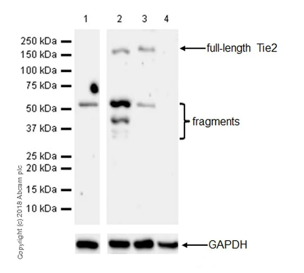 Western blot - Anti-TIE2 antibody [EPR21915] (AB221154)