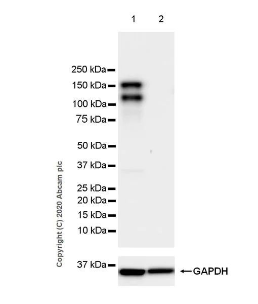 Western blot - Anti-TIE2 antibody [EPR23823-109] - BSA and Azide free (AB275749)