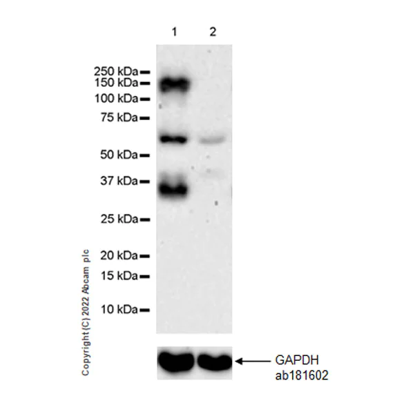 Western blot - Anti-TIE2 antibody [EPR26540-78] - BSA and Azide free (AB307557)