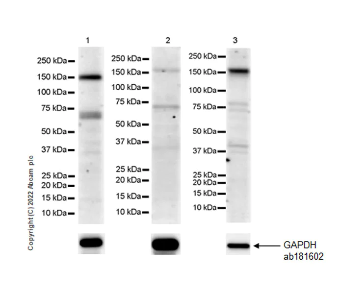 Western blot - Anti-TIE2 antibody [EPR26540-78] - BSA and Azide free (AB307557)