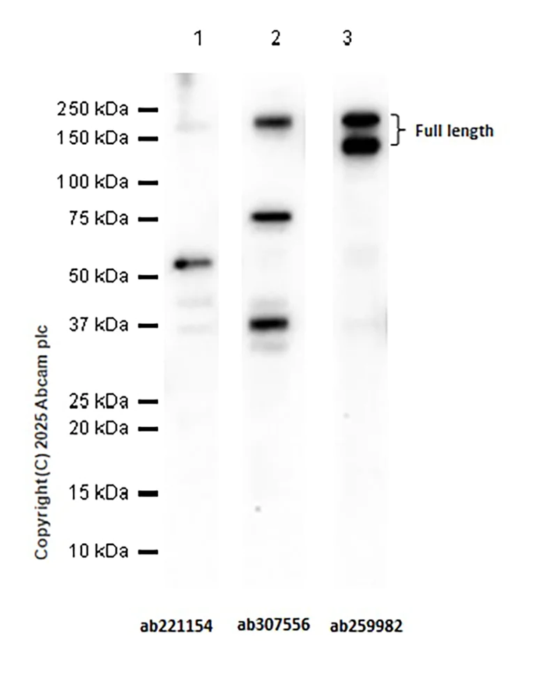 Western blot - Anti-TIE2 antibody [EPR26540-78] - BSA and Azide free (AB307557)